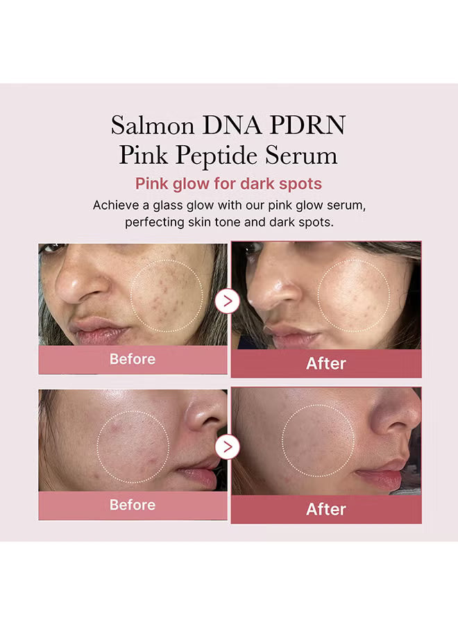 PDRN Pink Peptide Serum - Pink Glow Serum, Peptide, Niacinamide